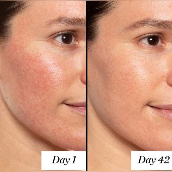 Sunday Riley A+ High-Dose Retinoid - Picture 4 of 9